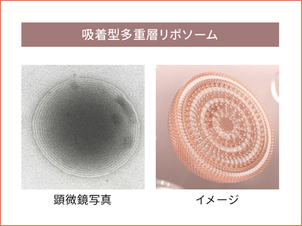リポソームの顕微鏡写真